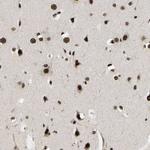 TBLR1 Antibody in Immunohistochemistry (Paraffin) (IHC (P))