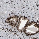 TBLR1 Antibody in Immunohistochemistry (Paraffin) (IHC (P))