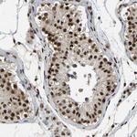 TBLR1 Antibody in Immunohistochemistry (Paraffin) (IHC (P))