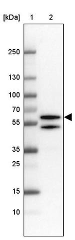 TBLR1 Antibody in Western Blot (WB)