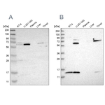 CAT1 Antibody in Western Blot (WB)