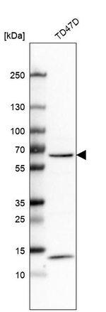 CAT1 Antibody in Western Blot (WB)