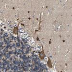 DSCAM Antibody in Immunohistochemistry (Paraffin) (IHC (P))