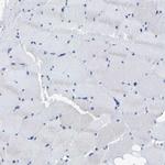 DSCAM Antibody in Immunohistochemistry (Paraffin) (IHC (P))
