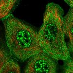 SLC4A2 Polyclonal Antibody