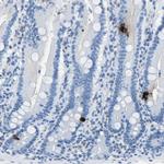 Somatostatin Antibody in Immunohistochemistry (Paraffin) (IHC (P))