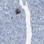 Somatostatin Antibody in Immunohistochemistry (Paraffin) (IHC (P))