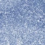 Somatostatin Antibody in Immunohistochemistry (Paraffin) (IHC (P))