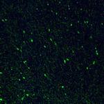 Somatostatin Antibody in Immunohistochemistry (Paraffin) (IHC (P))