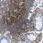 L-Plastin Antibody in Immunohistochemistry (Paraffin) (IHC (P))