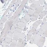 L-Plastin Antibody in Immunohistochemistry (Paraffin) (IHC (P))