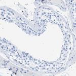 L-Plastin Antibody in Immunohistochemistry (Paraffin) (IHC (P))