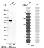L-Plastin Antibody in Western Blot (WB)