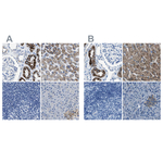 AMACR Polyclonal Antibody