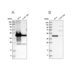 AMACR Antibody in Western Blot (WB)