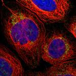 PARL Polyclonal Antibody