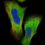 TDRKH Polyclonal Antibody