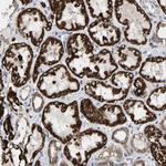 TDRKH Antibody in Immunohistochemistry (Paraffin) (IHC (P))