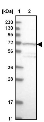 TDRKH Antibody in Western Blot (WB)