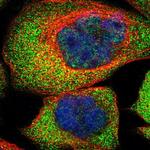 AKR1A1 Polyclonal Antibody