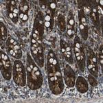 AKR1A1 Antibody in Immunohistochemistry (Paraffin) (IHC (P))