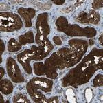 AKR1A1 Antibody in Immunohistochemistry (Paraffin) (IHC (P))