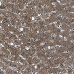 AKR1A1 Antibody in Immunohistochemistry (Paraffin) (IHC (P))