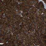 AKR1A1 Antibody in Immunohistochemistry (Paraffin) (IHC (P))