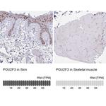 POU2F3 Antibody