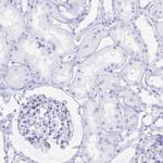 POU2F3 Antibody in Immunohistochemistry (Paraffin) (IHC (P))