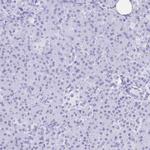 POU2F3 Antibody in Immunohistochemistry (Paraffin) (IHC (P))