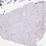 POU2F3 Antibody in Immunohistochemistry (Paraffin) (IHC (P))