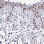 PLA1 Polyclonal Antibody