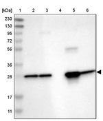 UCHL3 Antibody in Western Blot (WB)