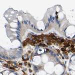 FNBP1 Antibody in Immunohistochemistry (Paraffin) (IHC (P))