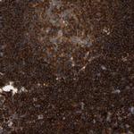 FNBP1 Antibody in Immunohistochemistry (Paraffin) (IHC (P))