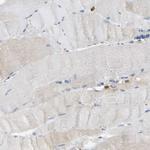 FNBP1 Antibody in Immunohistochemistry (Paraffin) (IHC (P))