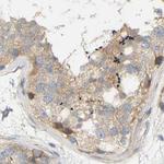 FNBP1 Antibody in Immunohistochemistry (Paraffin) (IHC (P))