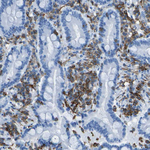 LSP1 Polyclonal Antibody