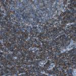 LSP1 Antibody in Immunohistochemistry (Paraffin) (IHC (P))