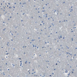 LSP1 Antibody in Immunohistochemistry (Paraffin) (IHC (P))