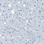 LSP1 Antibody in Immunohistochemistry (Paraffin) (IHC (P))