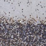 p130 Antibody in Immunohistochemistry (Paraffin) (IHC (P))