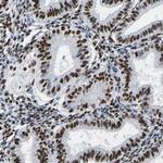 p130 Antibody in Immunohistochemistry (Paraffin) (IHC (P))