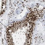 p130 Antibody in Immunohistochemistry (Paraffin) (IHC (P))