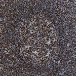 p130 Antibody in Immunohistochemistry (Paraffin) (IHC (P))