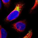 MDH2 Polyclonal Antibody