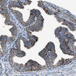 MDH2 Antibody in Immunohistochemistry (Paraffin) (IHC (P))