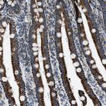 MDH2 Antibody in Immunohistochemistry (Paraffin) (IHC (P))