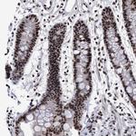 EFCAB10 Polyclonal Antibody